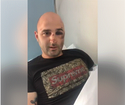 VIDEO/ “Policia nuk e bindi Tabakun të gënjente, thotë se shkrepi arma”