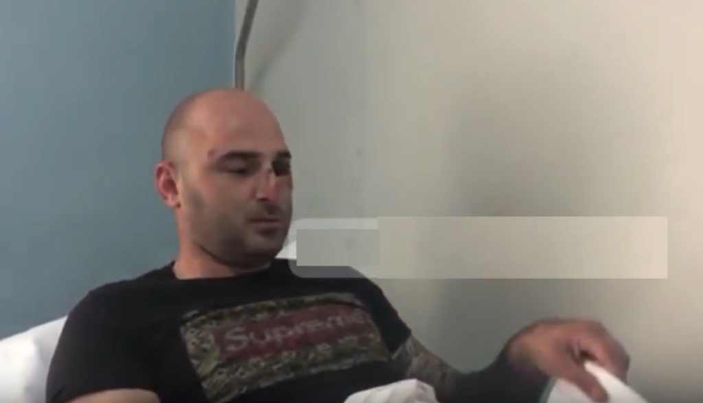 Kush është shoku problematik i Stresit, i plagosur në këmbë nga policia