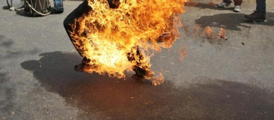 Djeg mbeturinat, digjet edhe vetë 74-vjeçari nga Shkodra