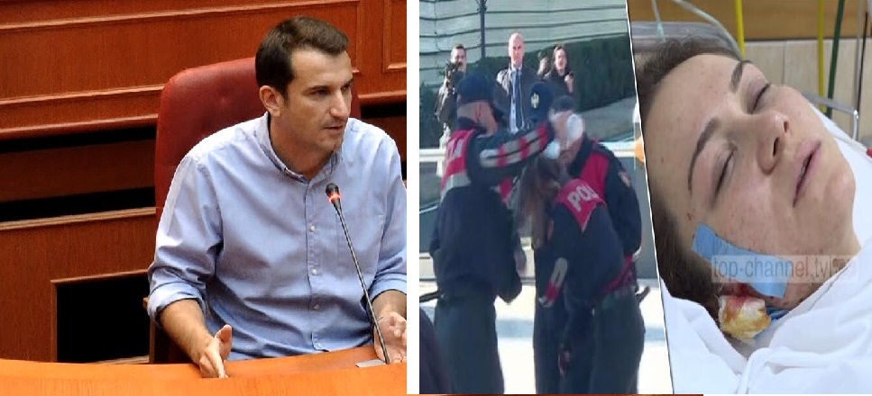 VIDEO/ Çmendet Erion Veliaj : Asnjë burrë nuk martohet me policen që i prenë gishtin