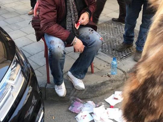 FOTO/Denoncimi i qytetarit: Maskat përgjakin kambistin,policia vjen me vonesë