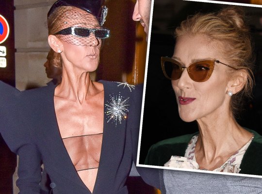 FOTO/Pamje tronditëse, këngëtarja e famshme nuk njihet më pas humbjes në peshë