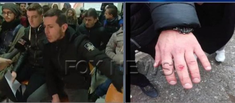 Policia e Shtetit shkel autonominë e Universitetit, studentët e Ekonomikut: Na dhunuan