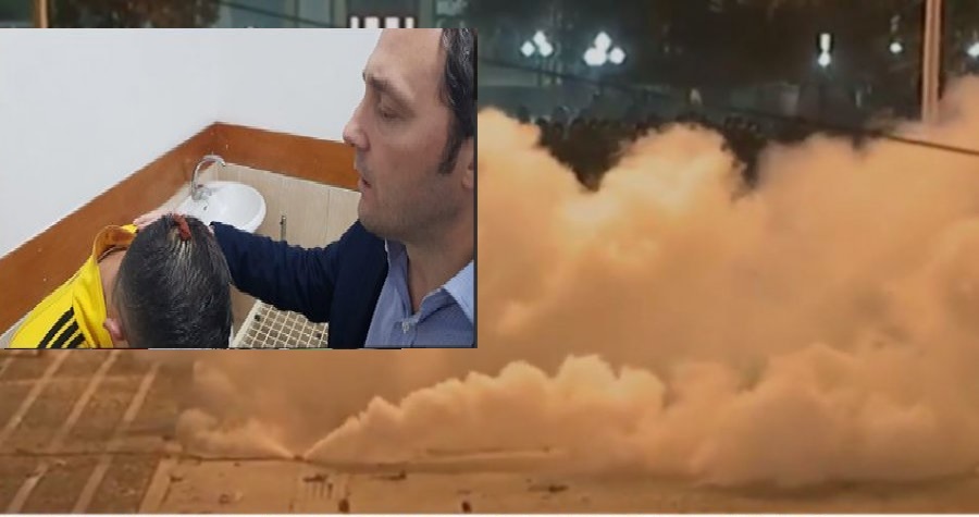 VIDEO/ Dhuna e Policisë ndaj protestuesve, Spahia viziton të plagosurit në spitale