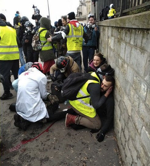 E dhimbshme, protestuesi “jelek verdhë” humb gishtat në trazirat e dhunshme në Francë