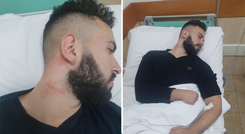 Doli të protestonte për bursën e mohuar, policia i nxjerr shpatullën studentit jetim