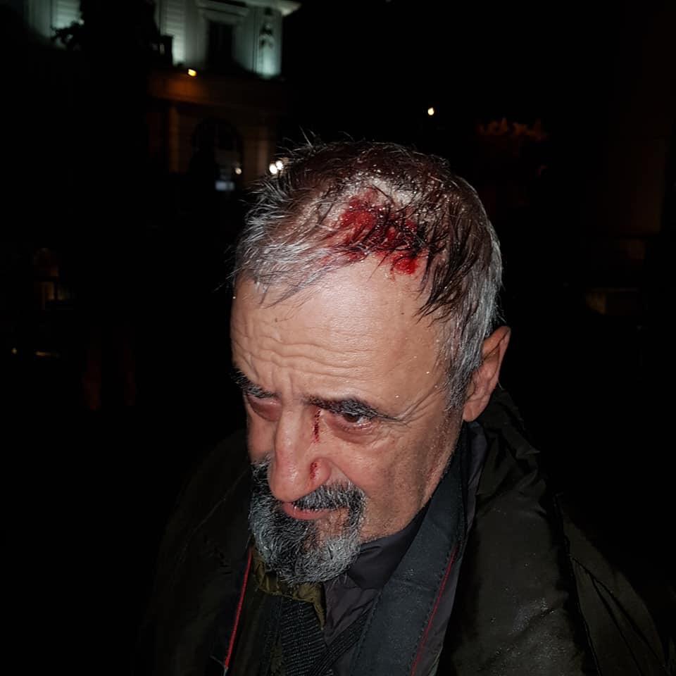 FOTO/ Pamje të rënda, fotografi dhunohet nga policia ne protestë