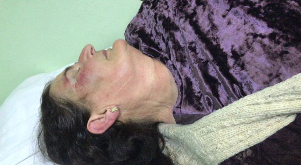 “Gruaja dhunohet nga bashkëshorti, policia nuk zbatoi urdhërin e mbrojtjes”