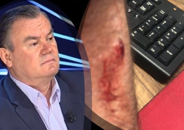 VIDEO/ Kalonte te protesta, Nikollë Lesi publikon pamjet e dhunës nga policia