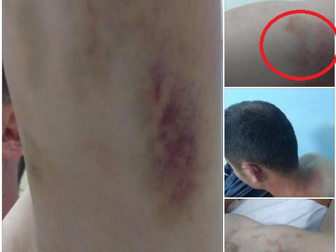 FOTO/ Denoncimi, Policia e Lushnjes dhunon pedagogun