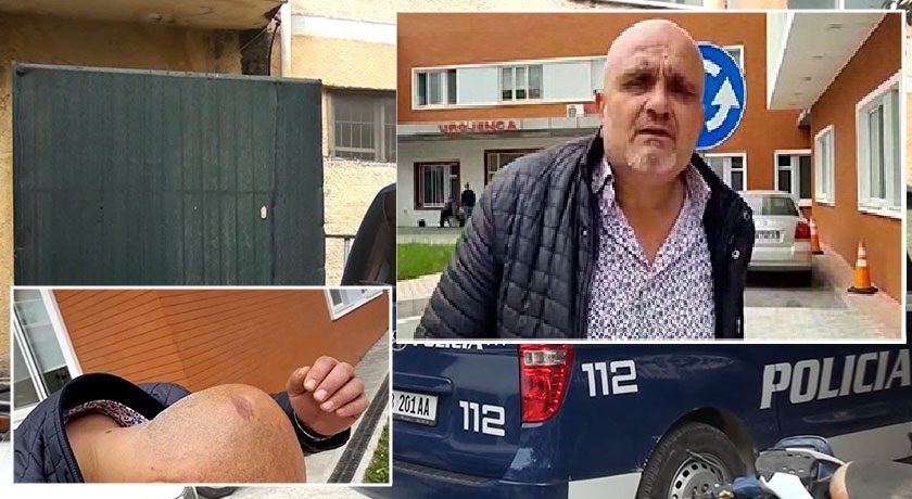 Ndodh në Sarandë, gruaja tenton të shtypë me makinë burrin për ti marrë pasurinë