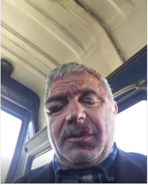 DENONCIMI/“Më masakruan vëllain, daja biznesmen i rilindasit ua mbylli gojën me para krimi”