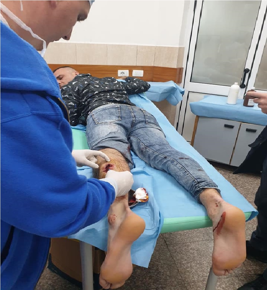 FOTO/ Ish-deputeti i PD publikon provën: I riu u plagos me armë nga policia