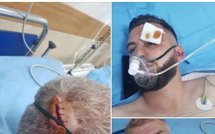 Berisha publikon fotot nga spitali: Plagë të rënda ndaj babait dhe djalit të tij gjatë protestës