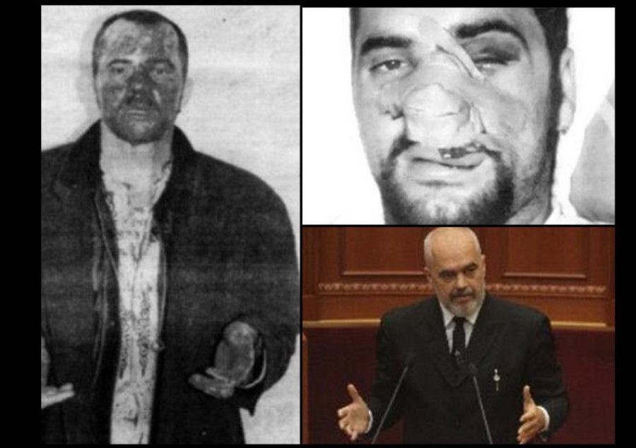 Sali Berisha paralajmëron Edi Ramën/ Po e publikove prapë këtë foto, do flas të vertetën