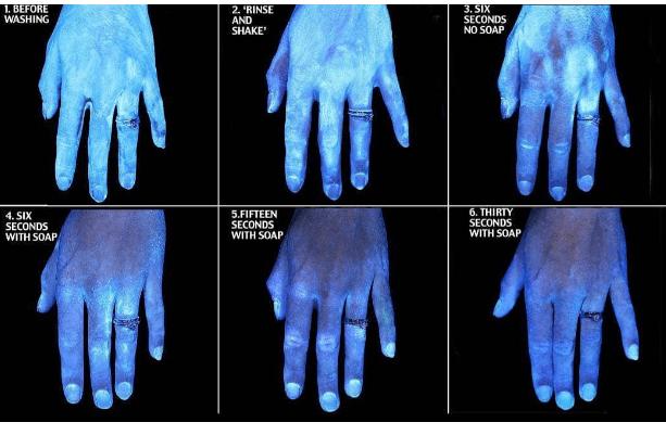 FOTO/Dezinfektuesi zgjedhje e shpejtë por jo aq efektive, pse larja e duarve është më e rëndësishme