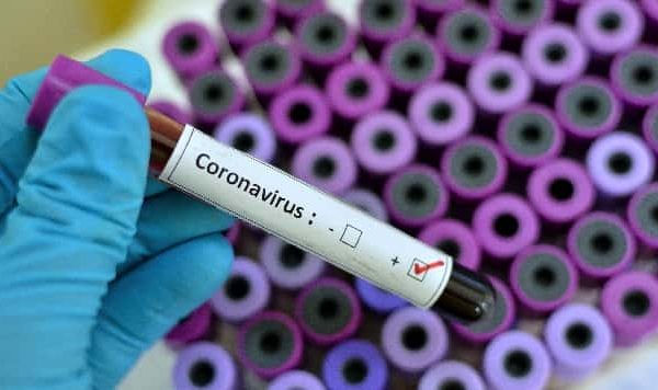 Ja si kryhet analiza e koronavirusit, testimi kushton pak