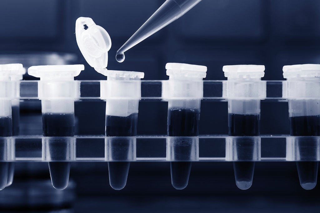 Aq shpejt sa përgjigja e shtatzënisë, miratohet testi më i ri që jep rezultatin për koronavirusin