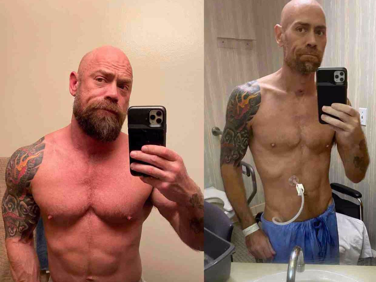 Infermieri bën krahasimin alarmant me foto: Ky është ndikimi që pati koronavirusi tek unë