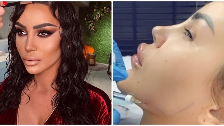 Këngëtares të njohur shqiptare i dalin fotot kur injekton botoks në fytyrë