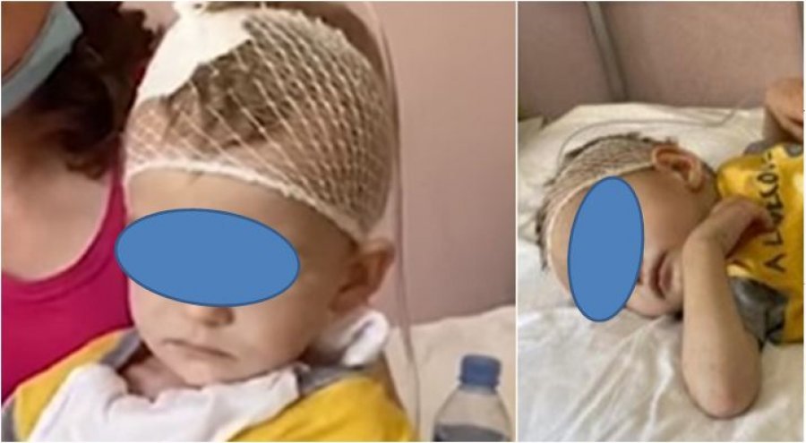‘Nuk u lejua nga shteti të shkonte për kurim në Itali’, ndërron jetë në spital 3-vjeçari