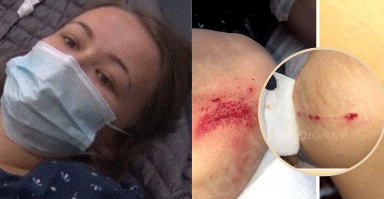 Gruaja shtatzënë sulmohet nga qentë endacakë në Prishtinë