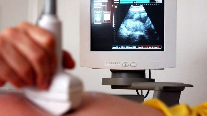 Gjinekologu del babai biologjik i 17 fëmijëve, reagon spitali: Mund të ketë edhe shumë të tjerë