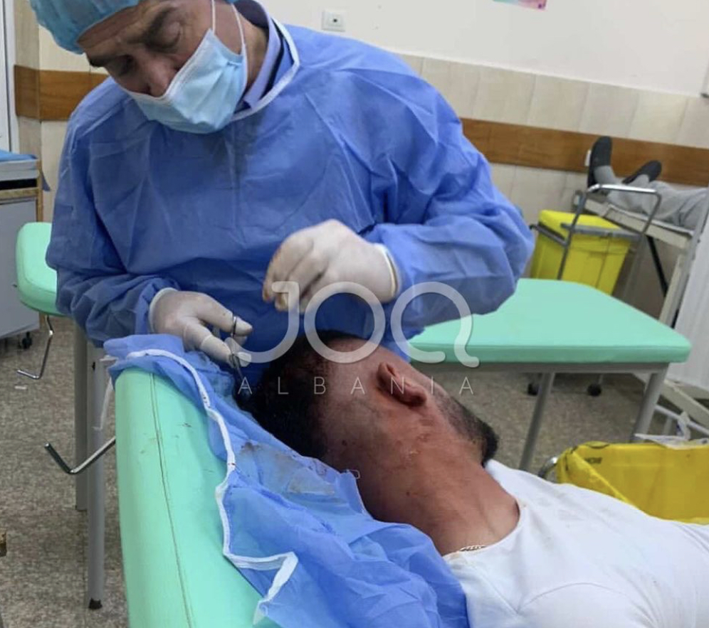 FOTO/ Ja si eshte rrahur protestuesi nga policet