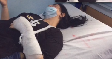 DIVJAKË/ Shefi i policisë i thyen krahun aktivistes së PD