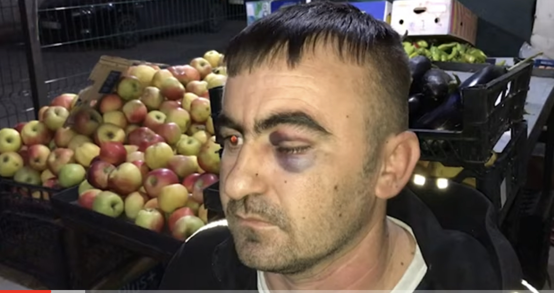 Pezullohet polici në Lushnjë, rrahu drejtuesin e mjetit për videon