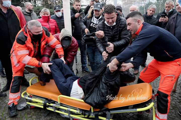 FOTOGALERI/ Fotot nga Feliks Bilani derisa e mbajti gazin dhe dhunën e policisë