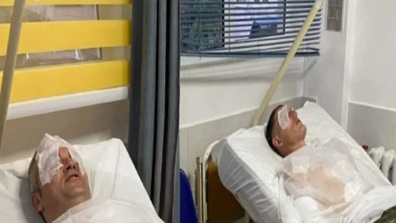 DETAJET/ Rusët që sulmuan në Gramsh janë arrestuar, si ndodhi sulmi dhe dyshimet për një celulë spiunazhi