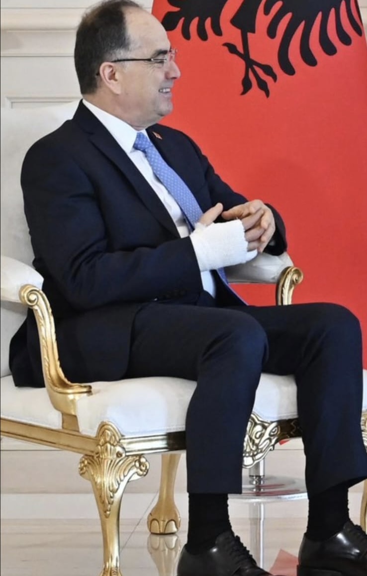 Çfarë i ka ndodhur Presidentit Begaj, çfaqet i lidhur me fasho