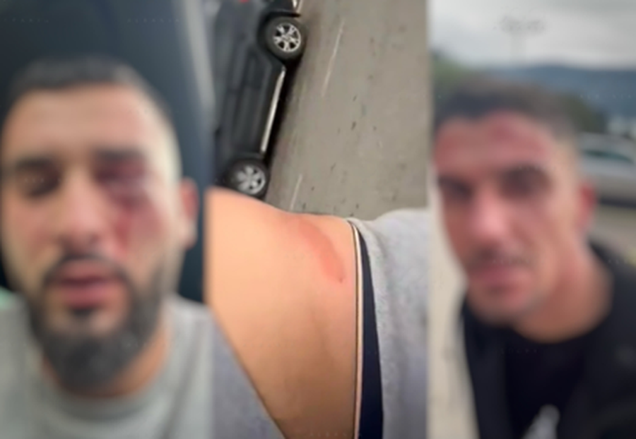 Rrahja brutale e 3 shqiptarëve në Herceg Novi, reagon Kryeministri malazes