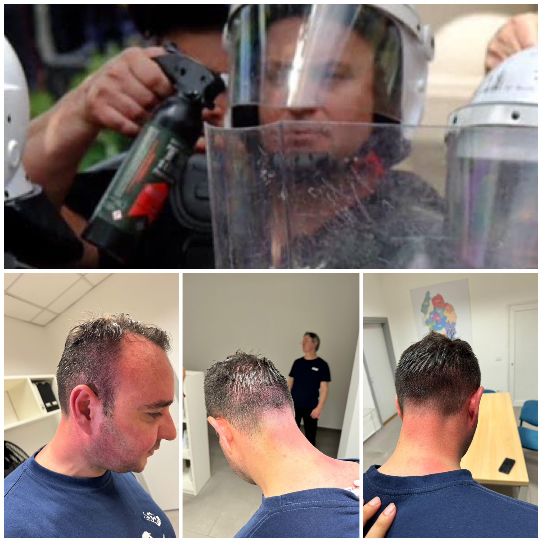 Protesta te bashkia, policia gaz neutralizues kundër protestuesve dhe drejtuesve të PD