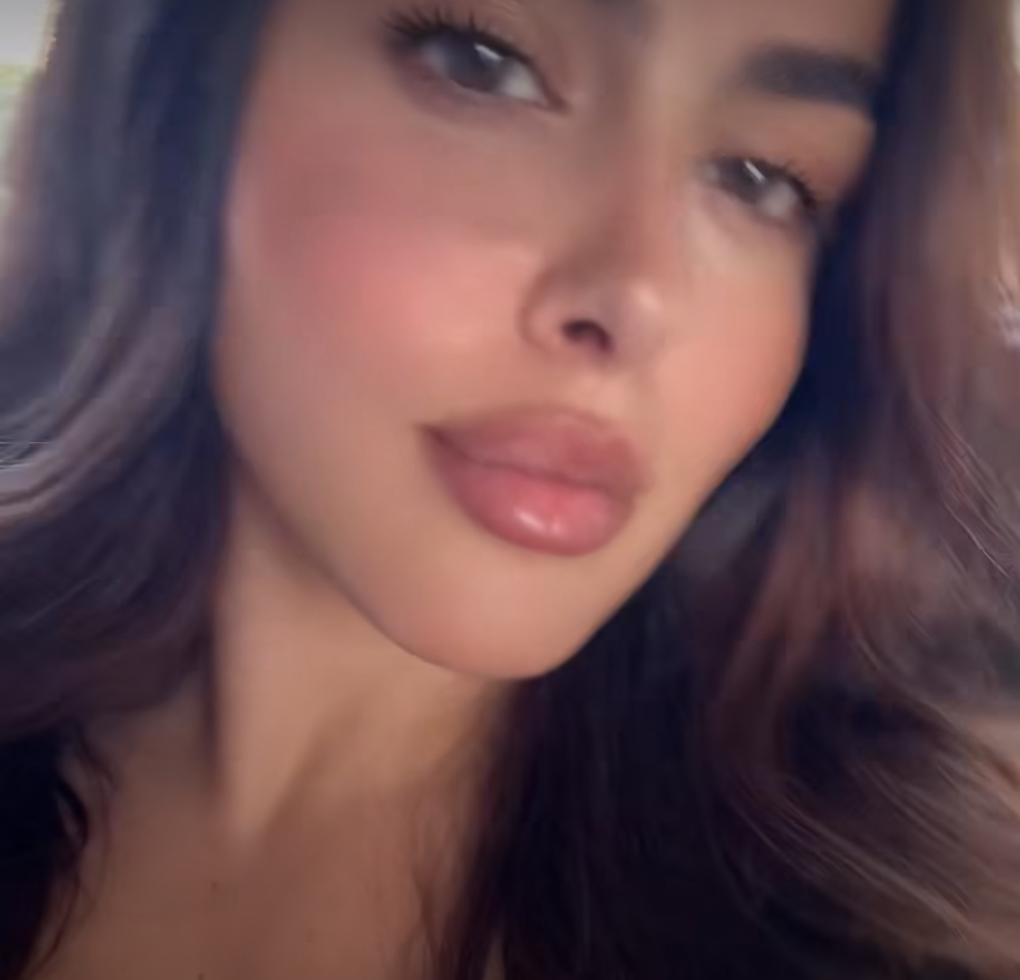 Klea Prenga po rikuperohet, nxjerr pamjen e re në Instagram